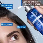 Uriage D.S. Hair Lotion spray korpás fejbőrre 100ml