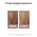 Eucerin Anti Pigment Dual szérum 30ml