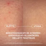 Bioderma Atoderm AD Intensive balzsam 400ml